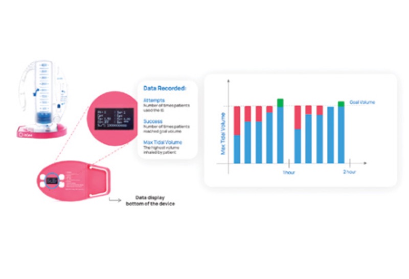 Tidal Medical Technologies: Top Biomedical Solutions Company 2023